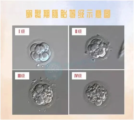 胚胎等级与成功率？国内供卵费用多少_代孕的优缺点
