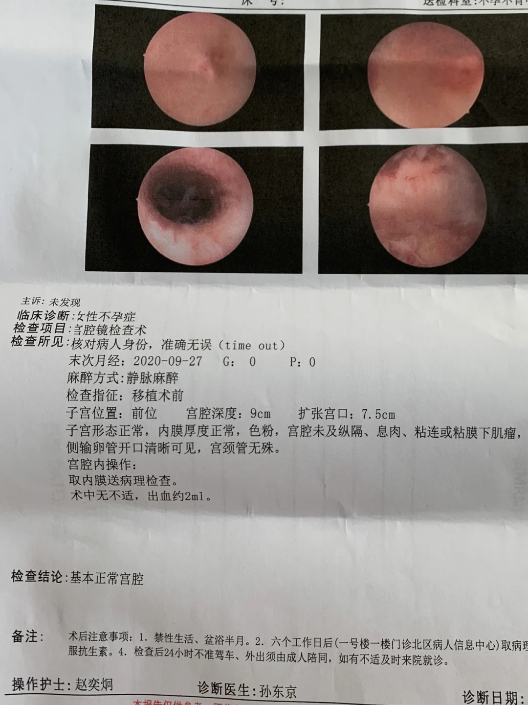 邵逸夫医院宫腔镜检查经历分享与费用解析